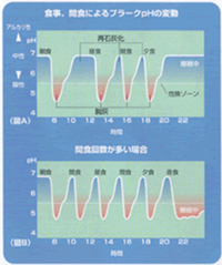 虫歯予防のポイント